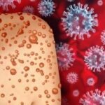mpoxxx Jangan Keluar Negeri Dulu, Thailand Laporkan Kasus Pertama Mpox Klade 1b yang Lebih Berbahaya