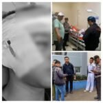 IMG 20251021 WA0000 Siswa SMK Teknika Cisaat Korban Pembacokan di Cibadak Masih Dirawat Intensif di RSUD Sekarwangi