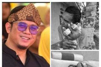 IMG 20251129 WA0004 Dua Kasus Penyakit Langka Muncul di Sukaraja dan Kabandungan, DPRD Sukabumi Desak Pemkab Bergerak Cepat