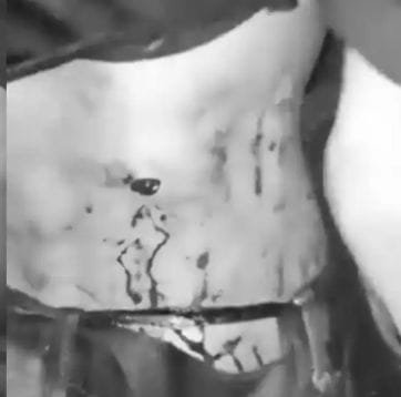 IMG 20260105 WA0021 Berandal Motor Beraksi Bacok Pemuda Asal Cianjur Di Curugkembar