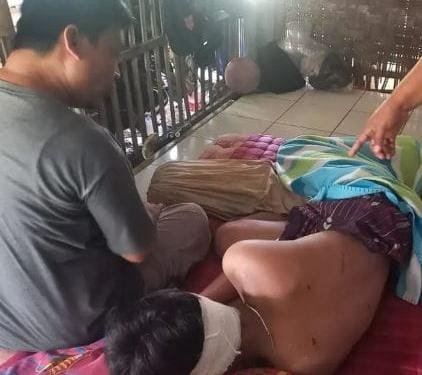 Korban pembacokan gerombolan pemotor di Ujunggenteng usai mendapat perawatan medis bersama keluarganya. (Prima Arno/Telusurbisnis)