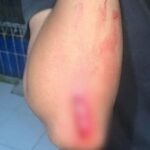 Korban gerombolan bersajam memperlihatkan bagian lengannya yang terluka. (Prima Arno/Terlusurbisnis)