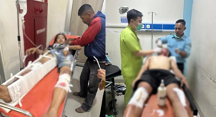 Tabrakan Ambulans Baznas dan Pick Up di Cikembar, Remaja 14 Tahun Patah Tulang 1 Dua korban kecelakaan lalu lintas antara ambulans milik Baznas Kabupaten Sukabumi dan sebuah mobil pick up di Kampung Pasirgabig, Desa Bojongkembar